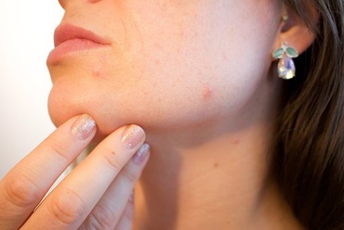 inflammatory acne treatments